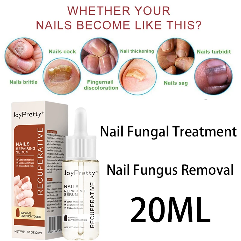 Nail Fungal Treatment Feet Essence Against Fungal Nail Oils Nail Fungus Removal Gel Anti Infection Paronychia Onychomycosis Care
Nail Fungal Treatment Feet Essence Against Fungal Nail Oils Nail Fungus Removal Gel Anti Infection Paronychia Onychomycosis Care