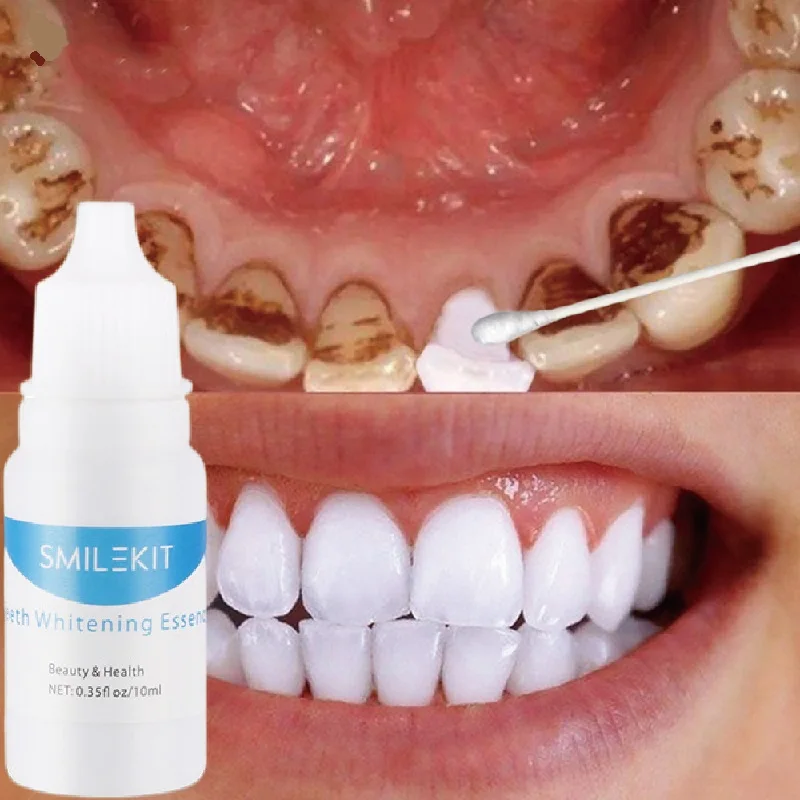 Teeth Whitening Essence Remove Stains Smoke Coffee Plaque Deep Cleaning Dental Oral Hygiene Fresh Breath Tooth Care Products
Teeth Whitening Essence Remove Stains Smoke Coffee Plaque Deep Cleaning Dental Oral Hygiene Fresh Breath Tooth Care Products