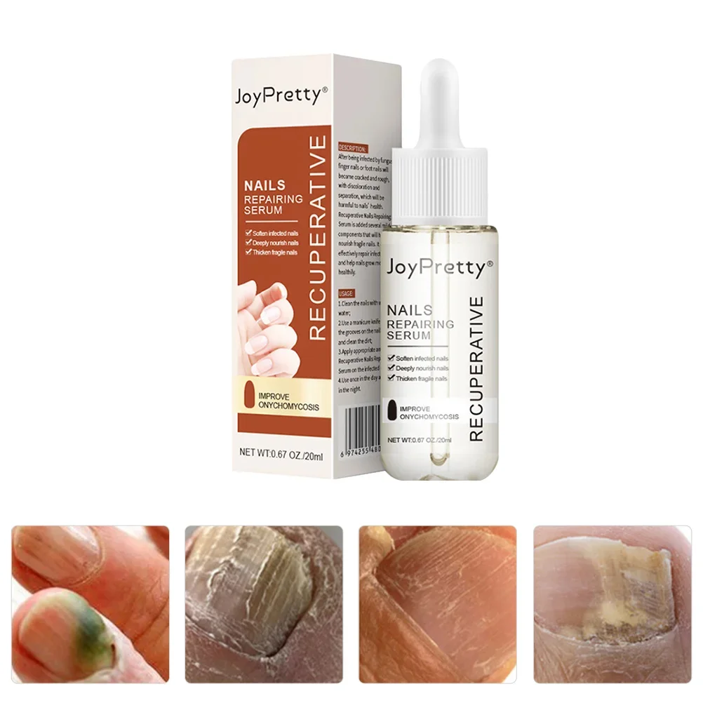 Nail Repair Liquid Nails Serum Fingernail Solution Toenail Nourishing Strength Care Essence Repairing Damaged Growth Uñas
Nail Repair Liquid Nails Serum Fingernail Solution Toenail Nourishing Strength Care Essence Repairing Damaged Growth Uñas