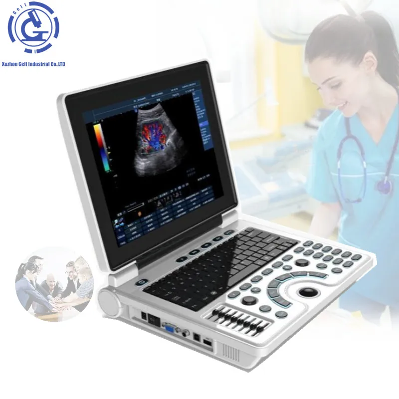 ecograf portatil color doppler 3d Ultrasound with Color Doppler Function Medical Device
ecograf portatil color doppler 3d Ultrasound with Color Doppler Function Medical Device