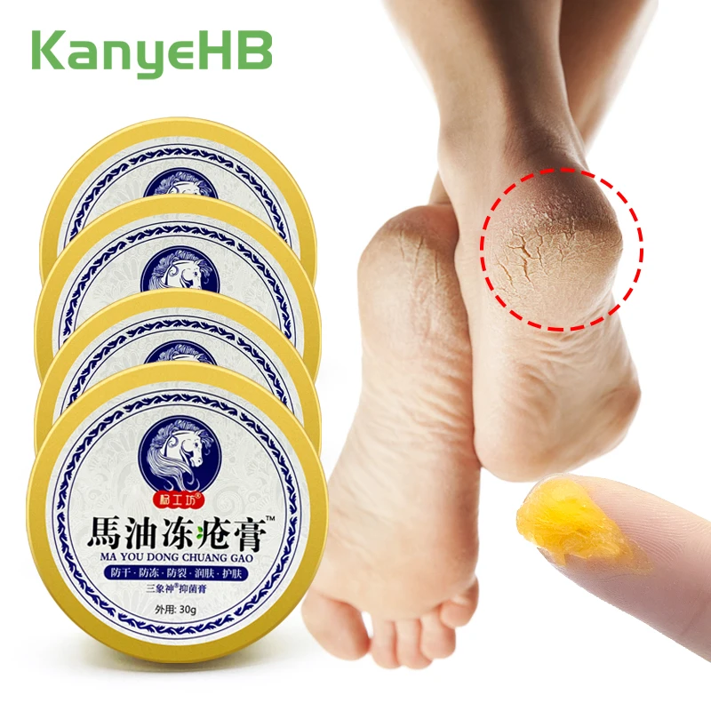 1-2-4pcs Horse Oil Foot Heel Cracked Cream Treatment Hand Frostbite Crack Moisturizing Relieve Skin Drynes Foot Mask Health Care
1-2-4pcs Horse Oil Foot Heel Cracked Cream Treatment Hand Frostbite Crack Moisturizing Relieve Skin Drynes Foot Mask Health Care