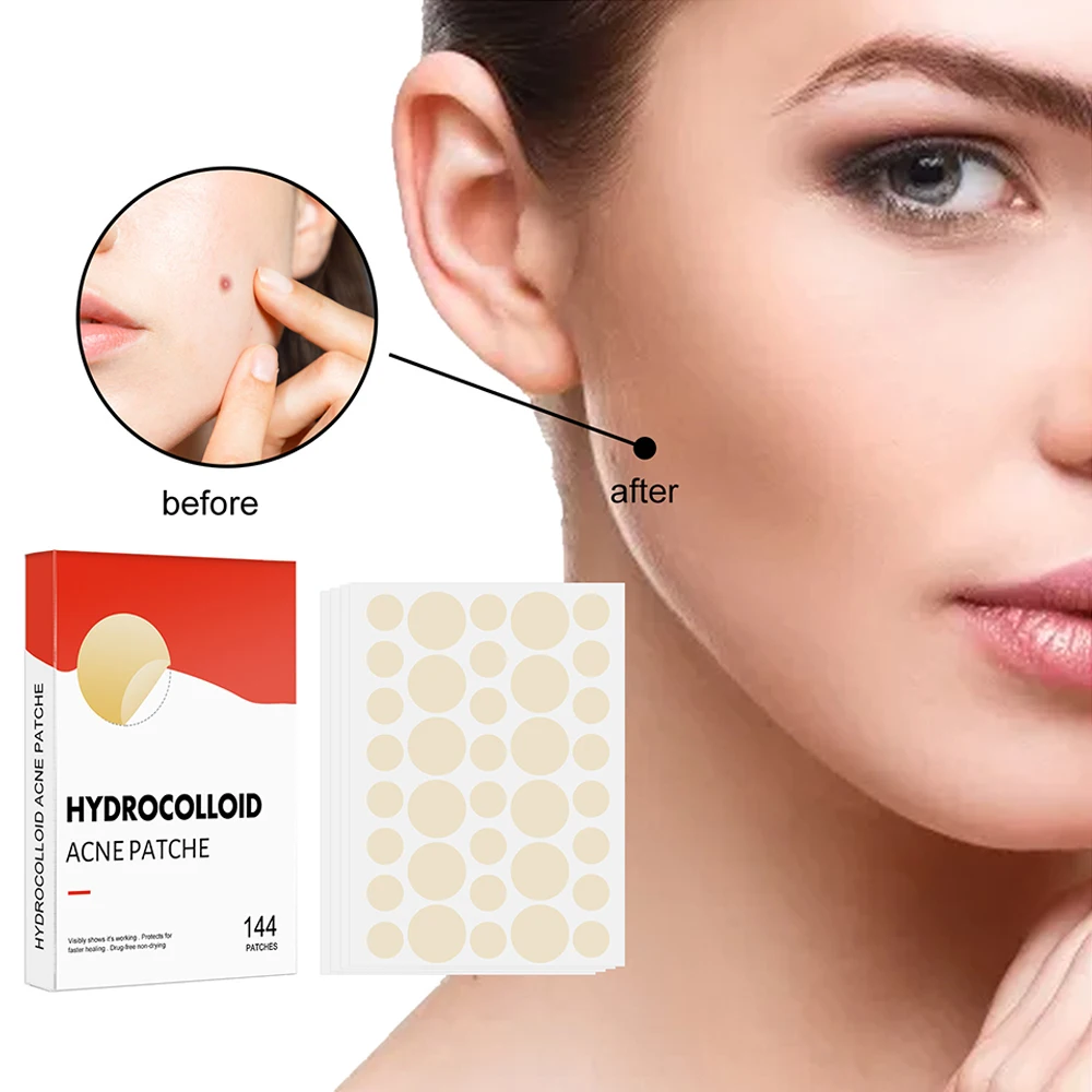 Hydrocolloid Acne Patch Invisible Makeup Closed Acne Patch Clean Acne Waterproof Breathable Acne Muscle Repair Patch
Hydrocolloid Acne Patch Invisible Makeup Closed Acne Patch Clean Acne Waterproof Breathable Acne Muscle Repair Patch