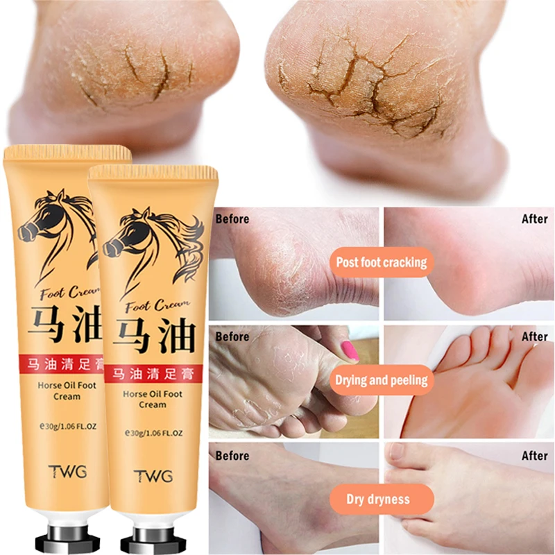 

30g Horse Oil Anti Crack Foot Cream Heel Cracked Repair Cream Smooth Removal Dead Skin Callus Anti-Drying Hand Feet Skin Care
