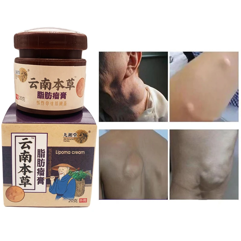 20g Treatment Lipoma Removal Cream Skin Swelling Cellulite Remover Ointment Lipolysis Fat Lump Body Hard Block Removal Medicine
20g Treatment Lipoma Removal Cream Skin Swelling Cellulite Remover Ointment Lipolysis Fat Lump Body Hard Block Removal Medicine