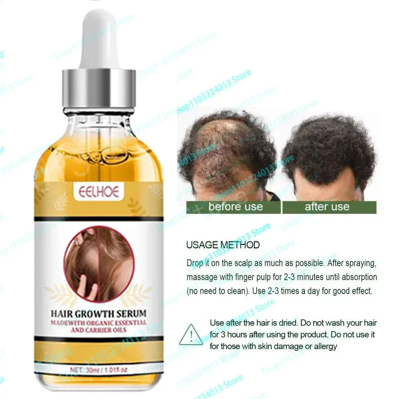 Biotin Hair Growth Products for Men Women Anti Hair Loss Fast Regrowth Thicken Oils Scalp Treatment Serum Hair Care
Biotin Hair Growth Products for Men Women Anti Hair Loss Fast Regrowth Thicken Oils Scalp Treatment Serum Hair Care