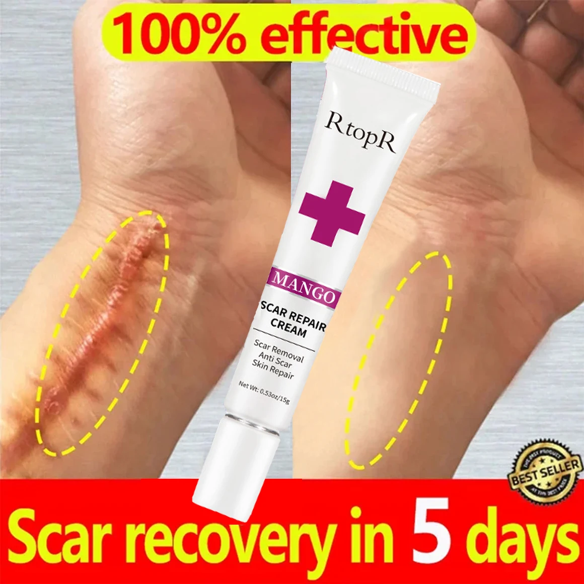 Fast Scar Removal Cream Treatment Stretch Mark Burn Skin Repair Smooth Face Treatment Blackhead Whitening Cream Beauty Skin Care
Fast Scar Removal Cream Treatment Stretch Mark Burn Skin Repair Smooth Face Treatment Blackhead Whitening Cream Beauty Skin Care