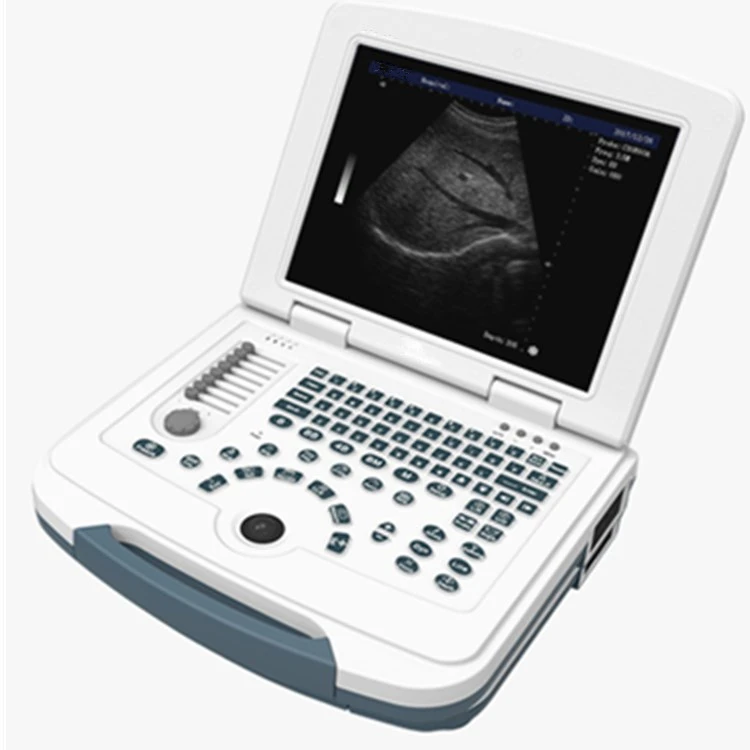 Good price portable ultrasound scanner laptop medical ultrasound machine price Ultrasound imaging detector
Good price portable ultrasound scanner laptop medical ultrasound machine price Ultrasound imaging detector