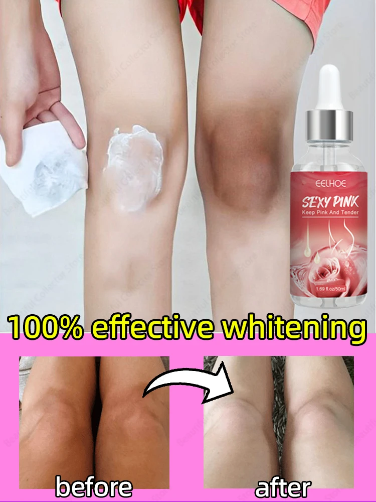 

Whitening Cream Private Parts Underarm Bleaching Serum Whiten Butt Knee Brighten Inner Thigh Intimate Parts Dark Remove Melanin