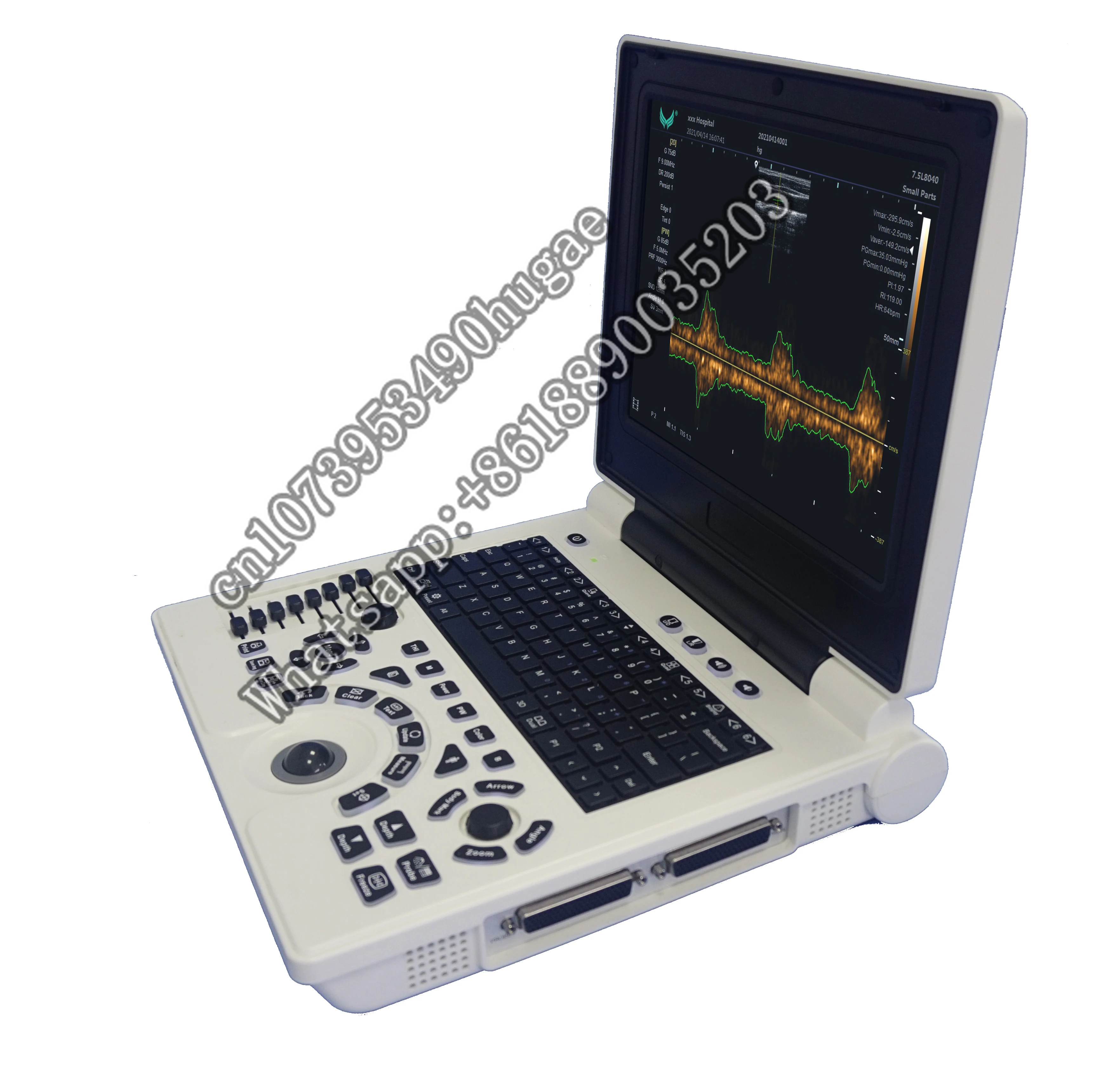 

Factory Manufacture Various P20 Notebook Ultrasonic Diagnostic System Machine China Premium Ultrasound
