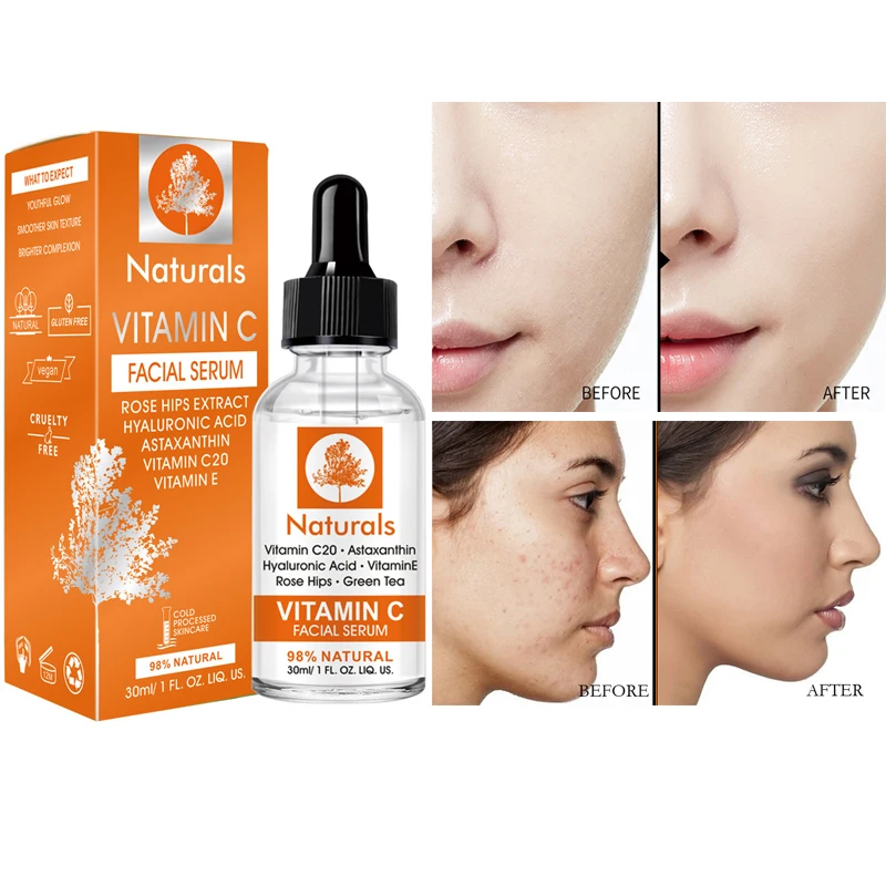 30ml Vitamin C Essence Moisturizing Face Serum Hydrating Whitening Shrink Pores Brighten Skin Lighten Spots Cosmetics Face Care
30ml Vitamin C Essence Moisturizing Face Serum Hydrating Whitening Shrink Pores Brighten Skin Lighten Spots Cosmetics Face Care