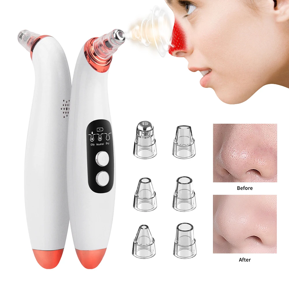 

Blackhead Removal Pore Vacuum Face Cleaner Electric Pimple Black Head Remover USB Rechargeable Facial Cleaning Tools Skin Care