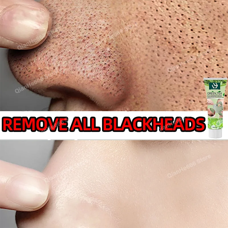 Blackhead Remover Nose Black Mask Facial Care Shrink Pore Acne Treatment Mask Peel Off Deep Cleansing Oil Control Pore Mask
Blackhead Remover Nose Black Mask Facial Care Shrink Pore Acne Treatment Mask Peel Off Deep Cleansing Oil Control Pore Mask