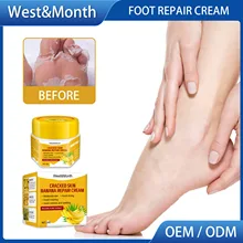 Crack Heel Cream Anti-Freezing Crack Anti-Chapping Nourishing Moisturizing Hand Heel Crack Cream Crack Foot Cream Heel Cream
Crack Heel Cream Anti-Freezing Crack Anti-Chapping Nourishing Moisturizing Hand Heel Crack Cream Crack Foot Cream Heel Cream