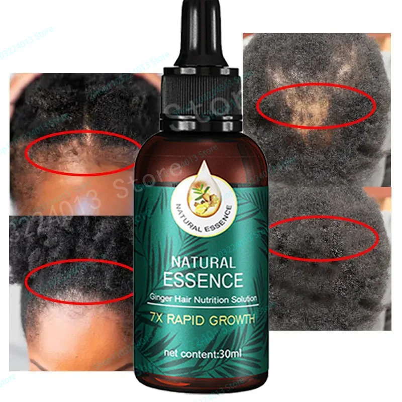 

Ginger Hair Growth Product Anti Hair Loss Serum Liquid Fast Grow Prevent Baldness for Men Women Hair Care Essential Oil