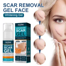 50ml Scar Removal Gel Face Pimples Stretch Marks Burns Acne Scar Treatment Skin Repairing Whitening Gel Skin Care Tool
50ml Scar Removal Gel Face Pimples Stretch Marks Burns Acne Scar Treatment Skin Repairing Whitening Gel Skin Care Tool