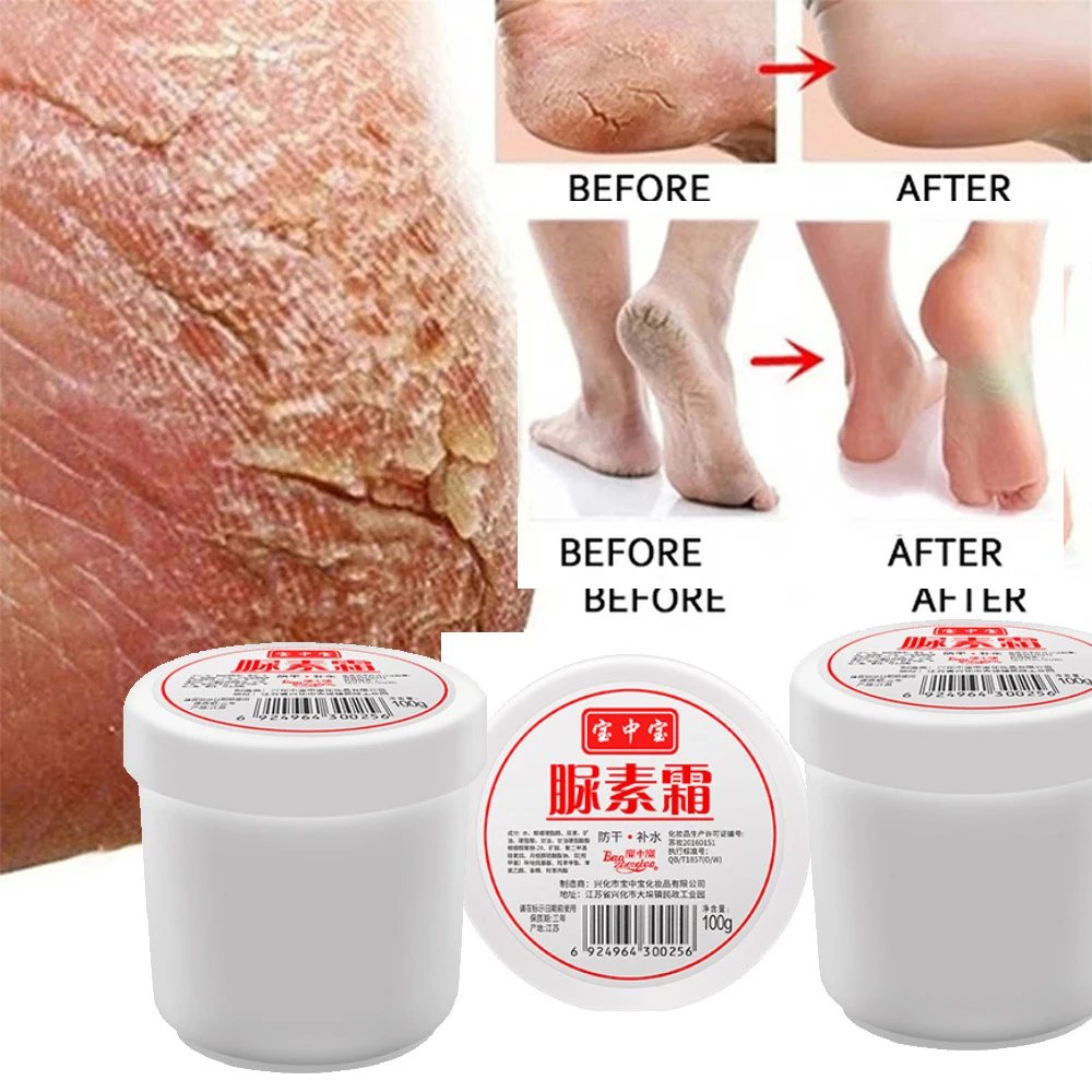 

3pcs Curing Keratosis Pilaris Kp Chicken Skin Body Lotion Skin Repair Cream Skin Care Essence Moisturizing And Nourishing 100g