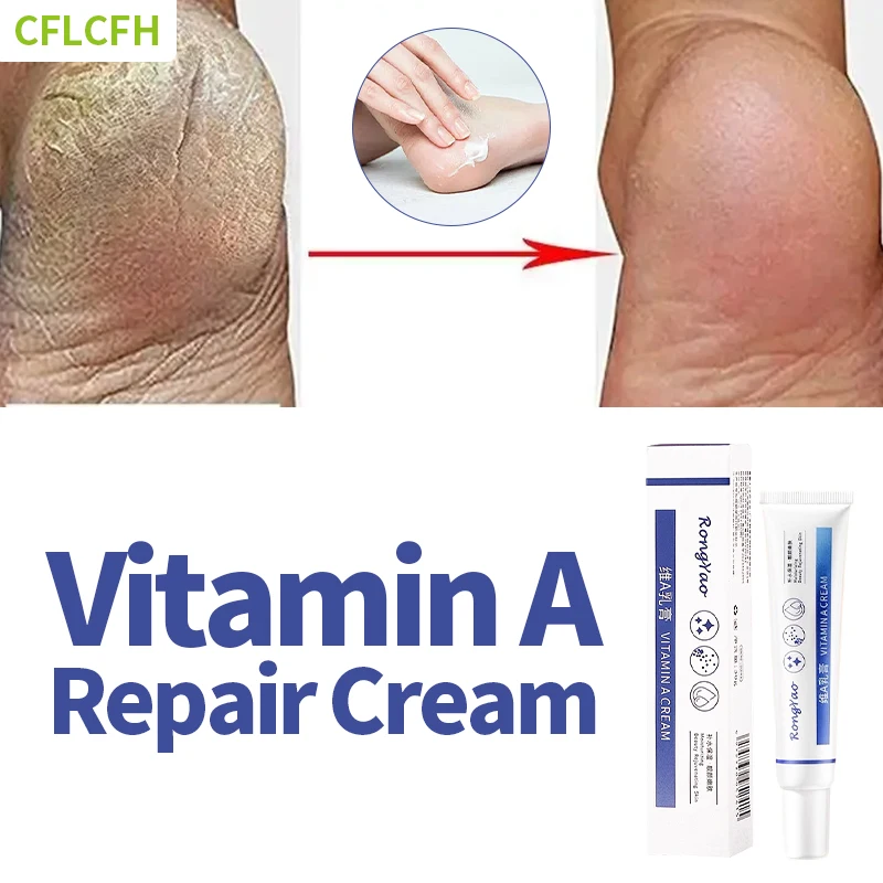 

30g Anti Crack Foot Care Cream Drying Cracked Feet Repair Treatment Hand Heel Dead Skin Removal Moisturizing Vitamin A Foot Mask