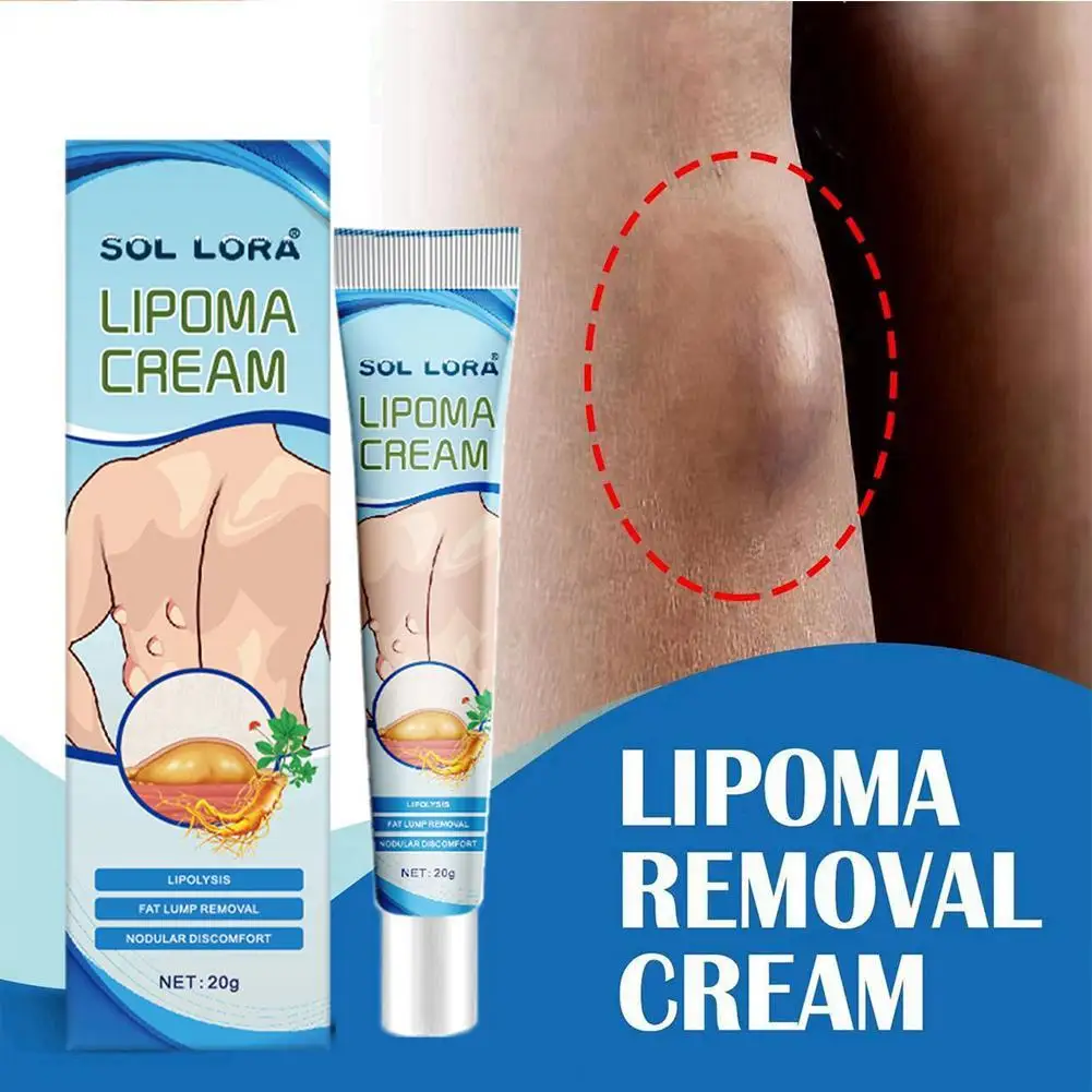 Lipoma Removal Cream Lipolysis Fat Lump Relief Plaster Skin Swelling Fat Elimination Cream Drop Shipping 20g Health Care
Lipoma Removal Cream Lipolysis Fat Lump Relief Plaster Skin Swelling Fat Elimination Cream Drop Shipping 20g Health Care