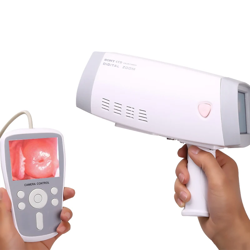 Simple innovative products Professional grade high end with Tripod Hospital Gynecology inspection equipment Video
Simple innovative products Professional grade high end with Tripod Hospital Gynecology inspection equipment Video