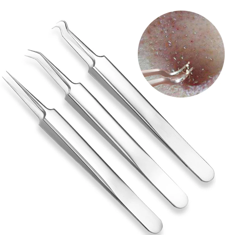 

1PC Stainless Steel Acne Needle Blackhead Remove Clips Face Skin Care Acne Comedone Blemish Pimple Remove Silver Tweezer Tools