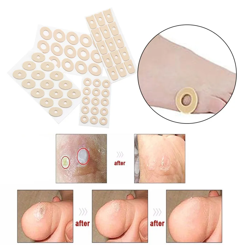 Anti-callus Foot Patch Latex Soft Foam Corns Patch High Heel Feet Pads Pain Foot Corns Bunion Protectors Pads Feet Treatment
Anti-callus Foot Patch Latex Soft Foam Corns Patch High Heel Feet Pads Pain Foot Corns Bunion Protectors Pads Feet Treatment