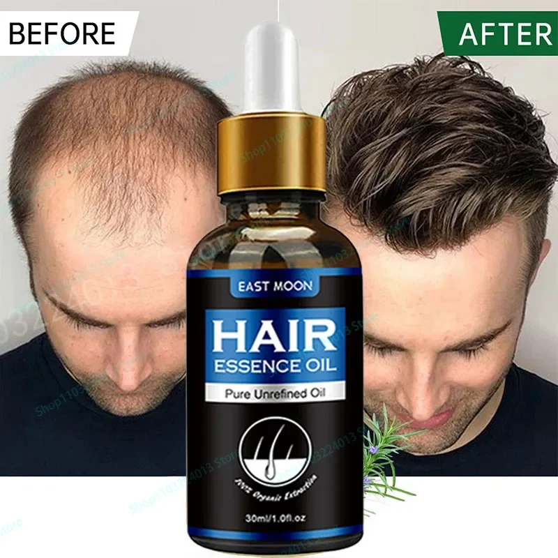 

Натуральное масло для роста волос эффективное против выпадения волос питательное эфирное масло для густого восстановления поврежденных волос увлажняющее гладкое масло