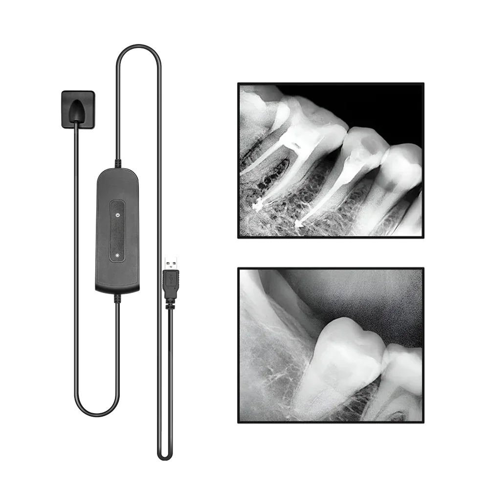 

Dentist Digital cameras Dental Sensor X-Ray High-Frequency Rx Digital Intraoral Digital System H D Image Radiovisografo
