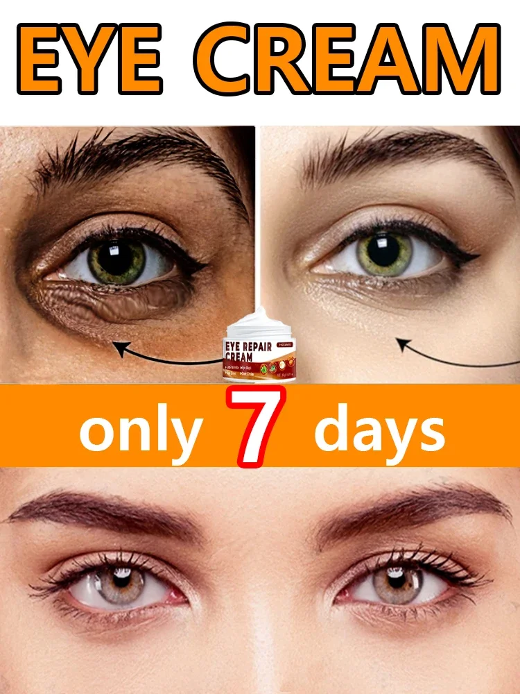 Eye cream eliminates eye bags, puffiness and dark circles Anti-wrinkle Hydration Anti-aging
Eye cream eliminates eye bags, puffiness and dark circles Anti-wrinkle Hydration Anti-aging