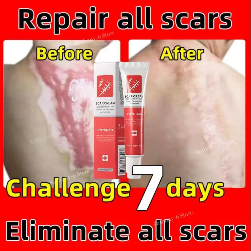 

7 Days Recovery Scar Cream Fast Removal Skin Scars Treat Surgery Scars Stretch Marks Acne Pox Prints Burn Repair Facial Care Gel