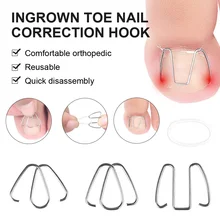Ingrown Toe Nail Correction Hook Front Nail Hook With 30Pcs Rubber Bands Nail Ingrown Clip Orthosis Paronychia Pedicure for Toe
Ingrown Toe Nail Correction Hook Front Nail Hook With 30Pcs Rubber Bands Nail Ingrown Clip Orthosis Paronychia Pedicure for Toe