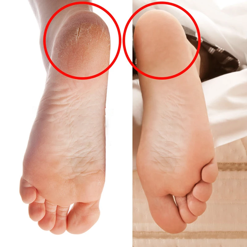 

1 Pair Silicone Foot Care Socks Non-slip Anti Cracking Moisturizing Gel Socks Cracked Dead Skin Remove Protector Pedicure Tools
