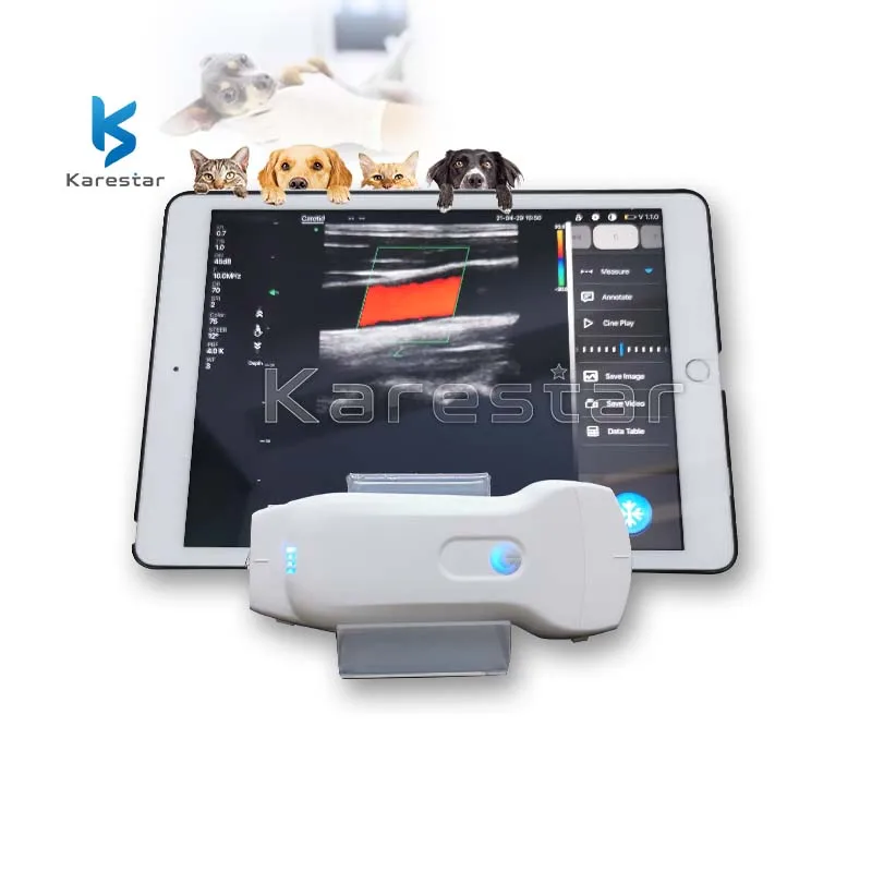 

Veterinary Ultrasound Karestar K-TC200 Double Head 3 in 1 Color Doppler Wireless Ultrasound Phased Array+Linear Probe