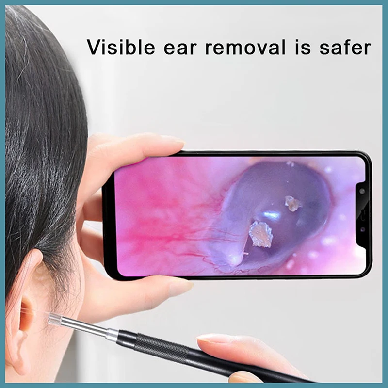 Smart Cell phone Visual HD Endoscopic Ear Picks Equipment With Light Earwax Removal Tool Portable Ear Care Kit
Smart Cell phone Visual HD Endoscopic Ear Picks Equipment With Light Earwax Removal Tool Portable Ear Care Kit