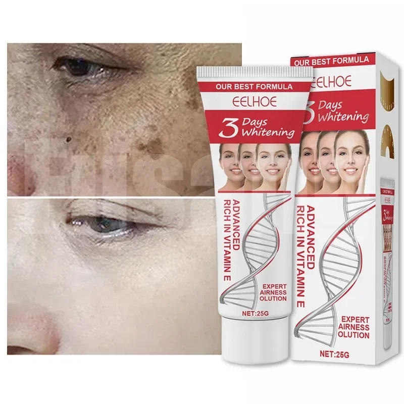 Dark Spots Remover for Face Removing Freckle Whitening Cream Chloasma Corrector Lighten Melanin Freckles Cream Women Facial Care
Dark Spots Remover for Face Removing Freckle Whitening Cream Chloasma Corrector Lighten Melanin Freckles Cream Women Facial Care