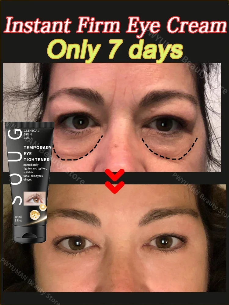 Instant Firm Eye Cream 7 Day Remove Puffine Eye Bag Dark Circles Lift Reduces Eye Under Wrinkle Fine Line Moisturizer Skin Care
Instant Firm Eye Cream 7 Day Remove Puffine Eye Bag Dark Circles Lift Reduces Eye Under Wrinkle Fine Line Moisturizer Skin Care