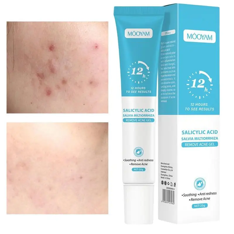 Salicylic Acid Acne Gel Fade Pimples Marks Anti-Pimple Clogging Cream Shrink Pores Remove Blackheads Oil Control Skin Care
Salicylic Acid Acne Gel Fade Pimples Marks Anti-Pimple Clogging Cream Shrink Pores Remove Blackheads Oil Control Skin Care