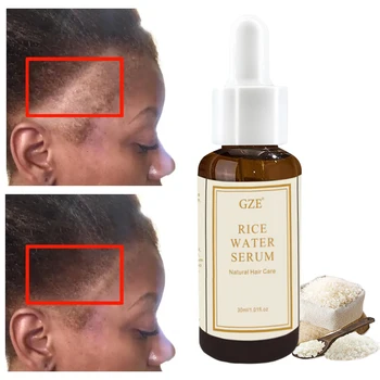 GZE 유기농 쌀물 세럼, 모발 성장, 스킨 케어, 쌀물 에센셜 오일, 남녀공용 모발 활성화 및 강화 상품 이미지