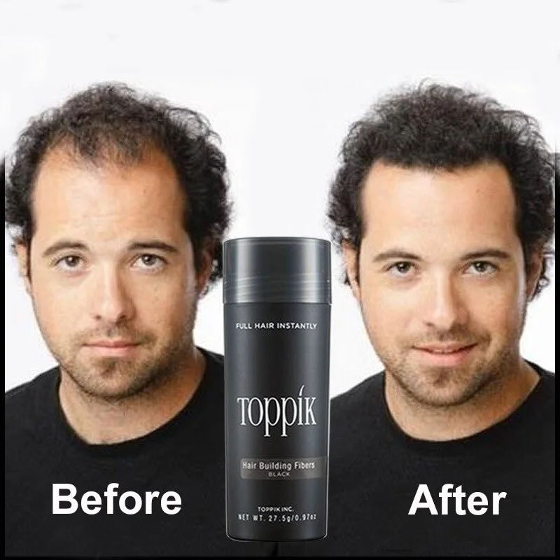 Toppik Hair Fibers Regrowth Powders Keratin Applicator Hair Building Fibers Spray Pump Hair Growth Products Hair Care 27.5g
Toppik Hair Fibers Regrowth Powders Keratin Applicator Hair Building Fibers Spray Pump Hair Growth Products Hair Care 27.5g