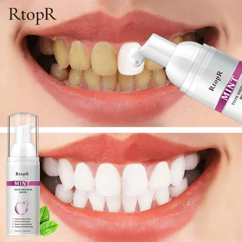 1~5PCS 60ml Teeth Cleansing Whitening Mousse Deep Cleaning Removes Cigarette Stains Teeth Whitening Repair Toothpaste Fresh
1~5PCS 60ml Teeth Cleansing Whitening Mousse Deep Cleaning Removes Cigarette Stains Teeth Whitening Repair Toothpaste Fresh