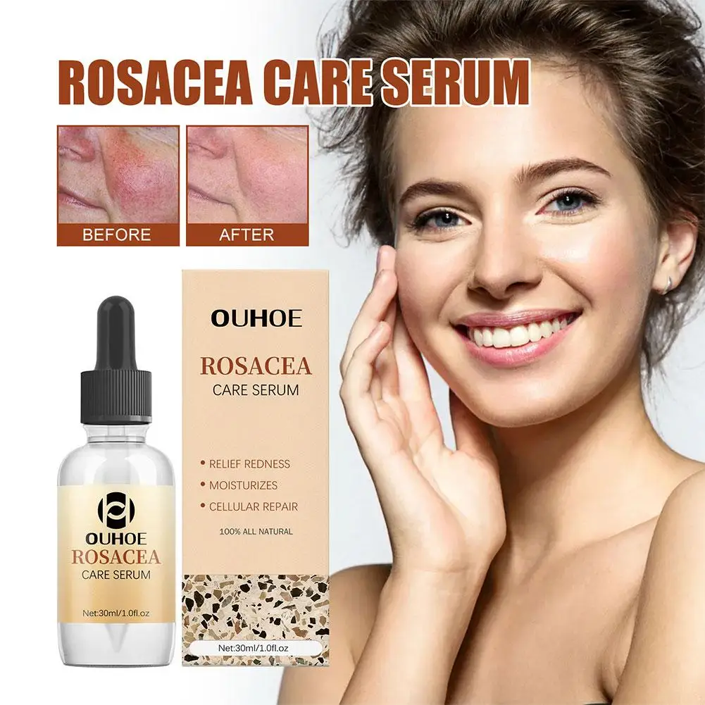 Rosacea Cure Serum Instant Repair Red Blood Sooth Itching Rosacea Serum Improve Skin Face Redness Care Moisturize K2c9
Rosacea Cure Serum Instant Repair Red Blood Sooth Itching Rosacea Serum Improve Skin Face Redness Care Moisturize K2c9