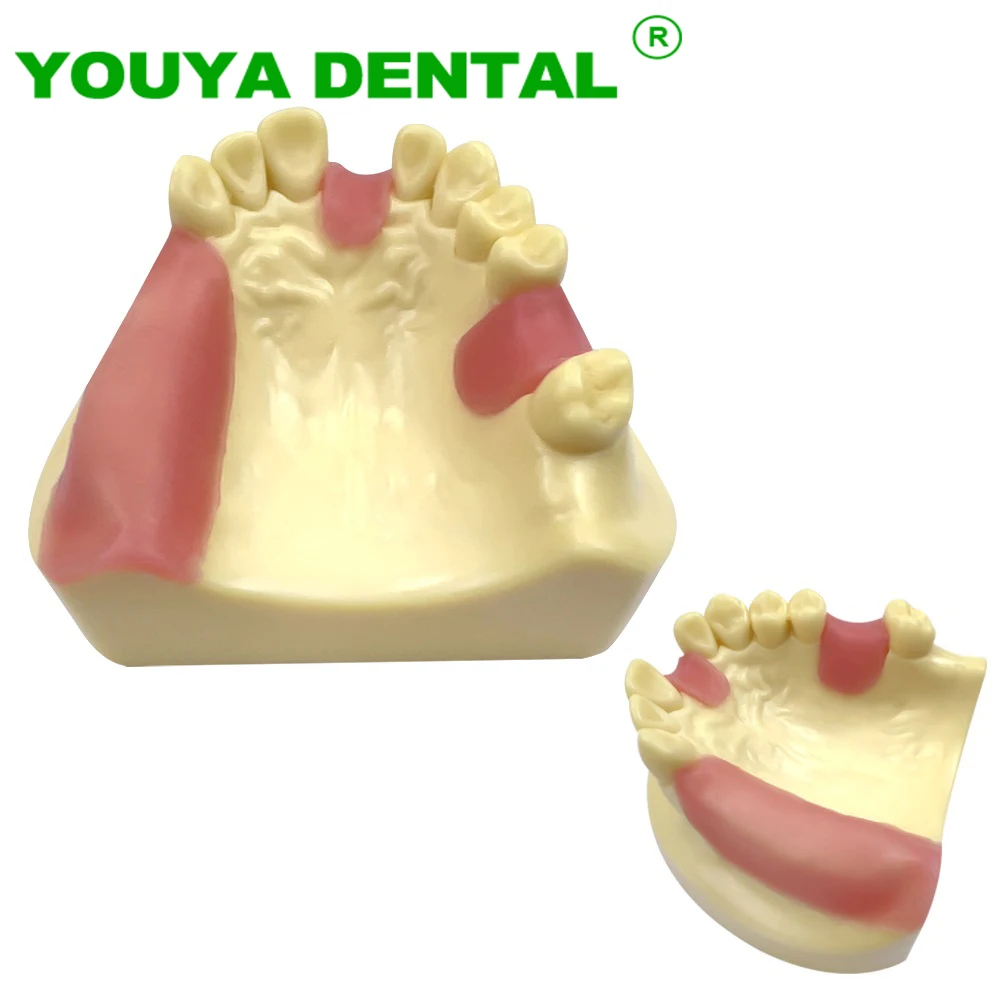 Dental Implant Practice Model Dentistry Study Teaching Teeth Jaw Typodont Model Dentist Education Training Demonstration Tools
Dental Implant Practice Model Dentistry Study Teaching Teeth Jaw Typodont Model Dentist Education Training Demonstration Tools
