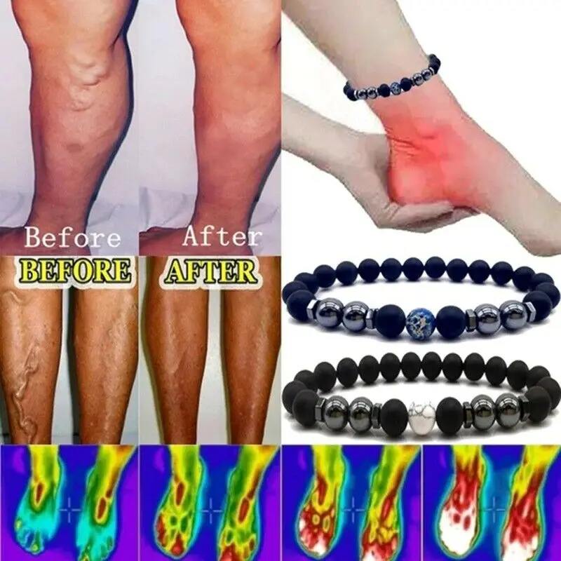 Фото Treatment of Varicose Veins Obsidian Anklet Adjustable Weight Loss Magnetic Therapy Magnet Bracelet for Mom Dad | Украшения и