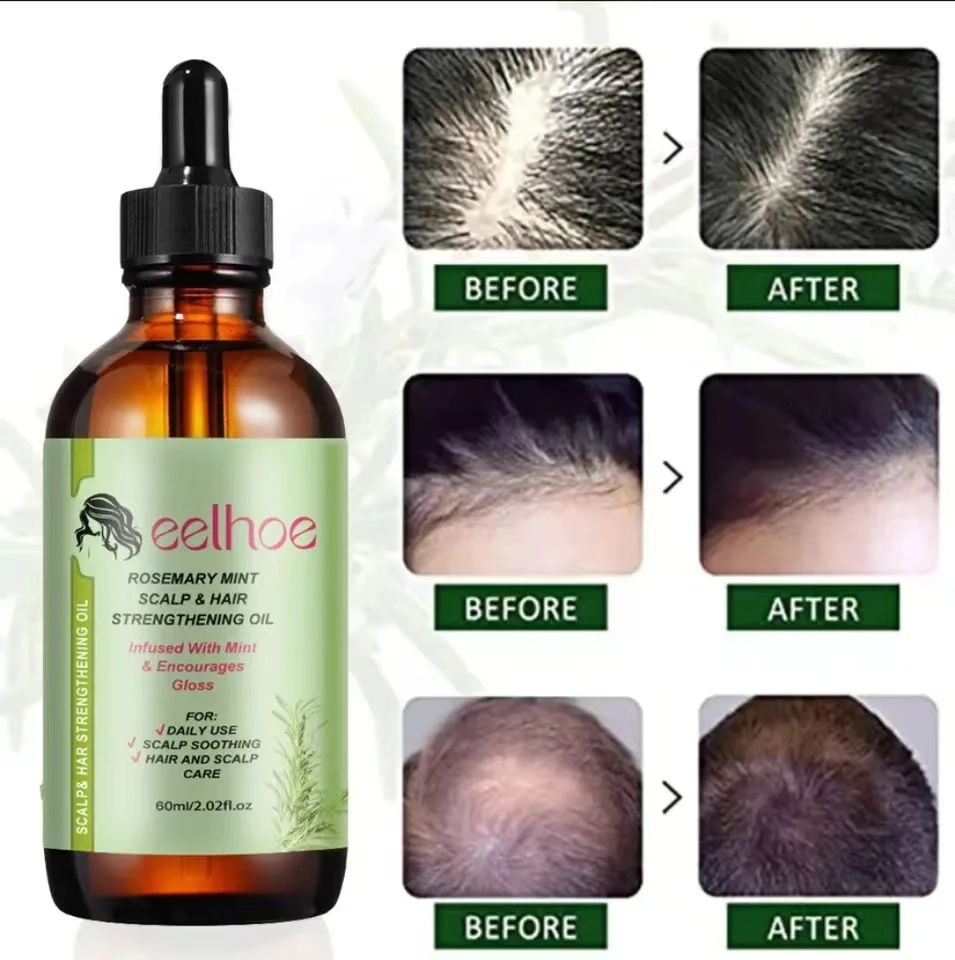Hair Growth Essential Oil Rosemary Mint Hair Strengthening Oil Nourishing Treatment for Split Ends and Dry Organics Hair
Hair Growth Essential Oil Rosemary Mint Hair Strengthening Oil Nourishing Treatment for Split Ends and Dry Organics Hair
