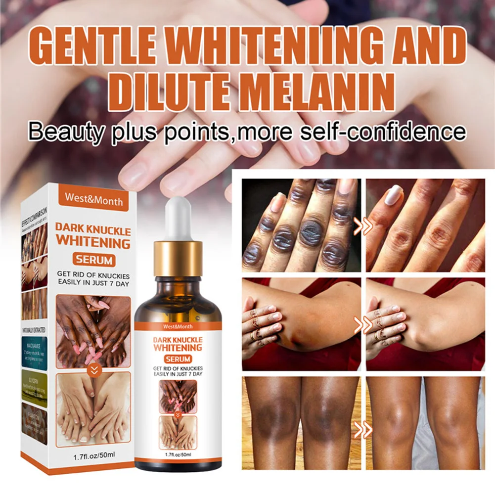 50ml Dark Kunckle Whitening Serum Improve Dullness Even Skin Tone Joints Elbows Knees Whitening Serum
50ml Dark Kunckle Whitening Serum Improve Dullness Even Skin Tone Joints Elbows Knees Whitening Serum