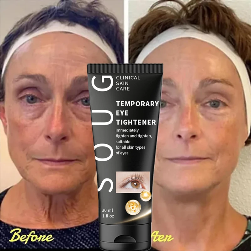 Anti Deep Dark Circles Cream Instant Removal Eye Bag Wrinkle Fine Lines Under the Eyes Contour Lift Firm Whiten Skin Beauty Care
Anti Deep Dark Circles Cream Instant Removal Eye Bag Wrinkle Fine Lines Under the Eyes Contour Lift Firm Whiten Skin Beauty Care
