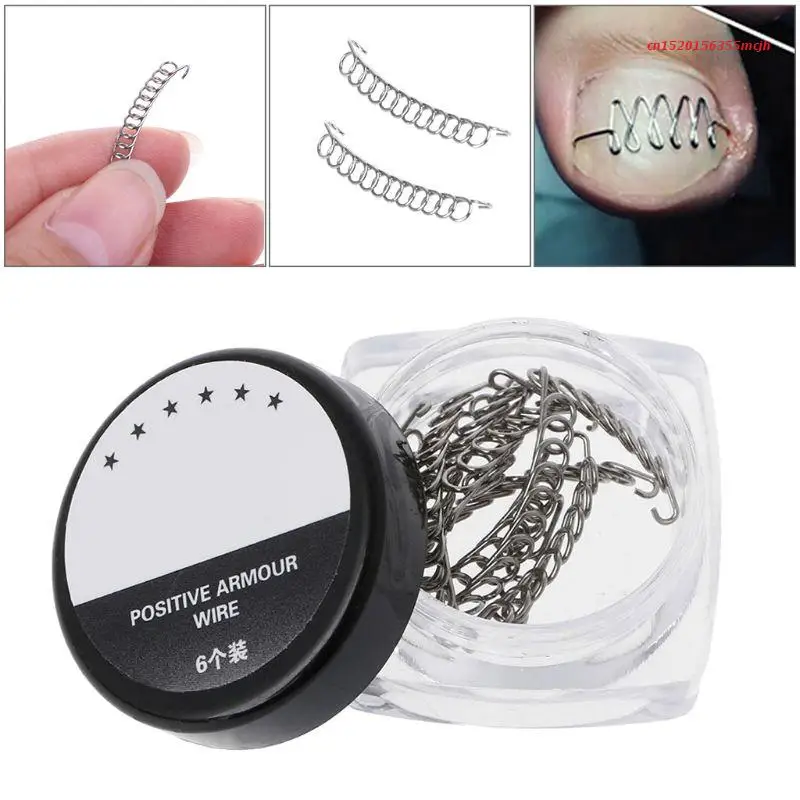 1BOX Ingrown Toe Nails Wire Correction Pedicure Wire Fixer Paronychia Recover Tool Home Drop Shipping
1BOX Ingrown Toe Nails Wire Correction Pedicure Wire Fixer Paronychia Recover Tool Home Drop Shipping
