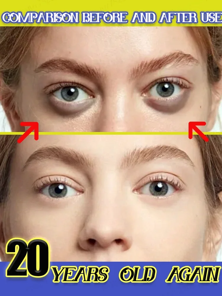 

Instant Eye Bags Cream Removal Eyes Wrinkle Fine Line