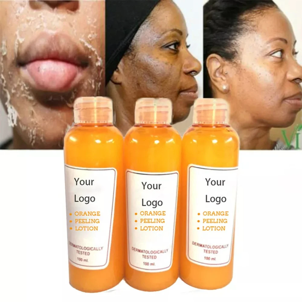 100ml Body Milk Whitening Dead Skin Exfoliating Strong Peeling Oil Refers The New Skin Anti-dark Spot Oil Effect Is Obvious New
100ml Body Milk Whitening Dead Skin Exfoliating Strong Peeling Oil Refers The New Skin Anti-dark Spot Oil Effect Is Obvious New