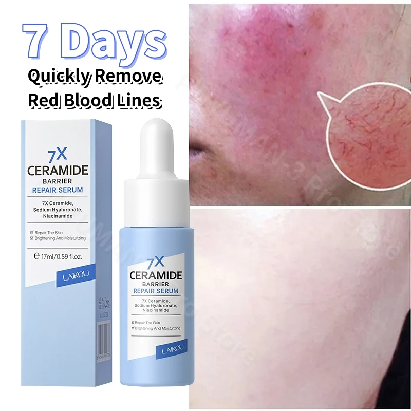 

7X Facial Redness Soothing Serum Instant Rosacea Red Blood Vein Treatment Improve Sensitive Skin Barrier Repair Korean Cosmetics