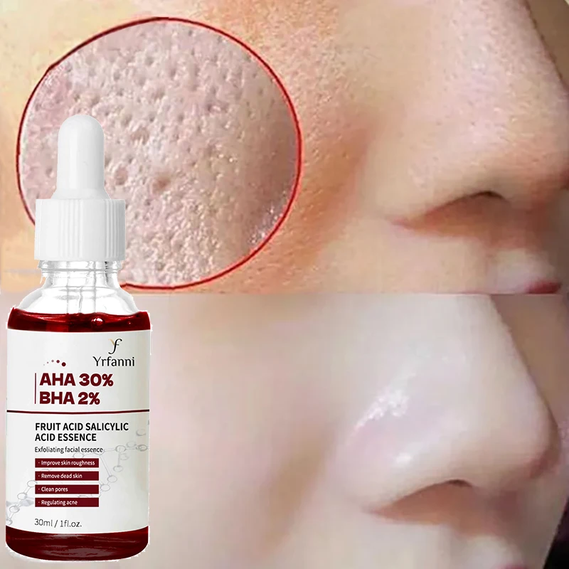 Pore Shrinking Serum Repairs Large Pores Salicylic Acid Face Essence Anti-wrinkle Facial Serum Oil Control Whitening Skin Care
Pore Shrinking Serum Repairs Large Pores Salicylic Acid Face Essence Anti-wrinkle Facial Serum Oil Control Whitening Skin Care